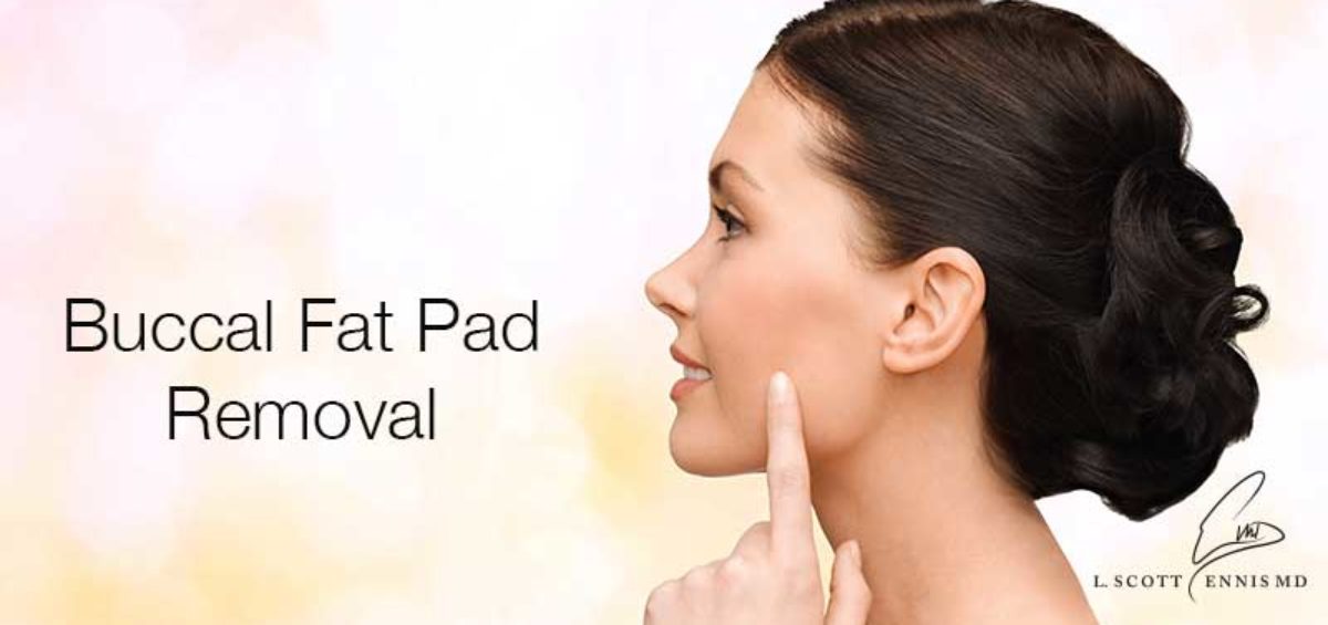 Buccal Fat Pad Removal to Contour the Face & Cheek Fat